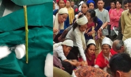 Bộ Y tế vào cuộc vụ sản phụ tử vong vì bị phá thai bằng que nứa