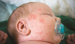 Nhiều thay đổi bất ngờ về tiêm chủng vắc-xin cho mẹ và bé 