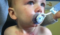 Chỉ một phút bất cẩn để con trai nghịch bình trà nóng, bà mẹ đau đớn khi thấy vết bỏng trên người con