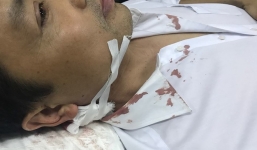 Một thiếu tá CSGT bị người vi phạm đâm trọng thương trước trụ sở công an quận