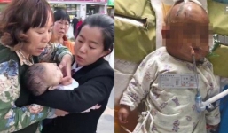 Bế cháu 3 tháng tuổi ra ngoài đi dạo, bà ngoại không thể ngờ một quả táo cũng có thể gây hại cho cuộc đời của cháu