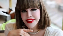 Cụ bà 81 tuổi bỏ tiền phẫu thuật thẩm mỹ, nhan sắc khiến ai cũng phải choáng váng