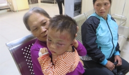 Tin tức mới nhất vụ bé trai 2 tuổi bị cha dượng bạo hành thâm tím mặt mũi