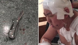 Nam sinh đâm bạn cùng phòng suýt chết vì bị phàn nàn ngủ ngáy