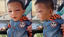 Bé 2 tuổi bị bạo hành ở Nghệ An: Bố dượng có tiền sử bệnh tâm thần