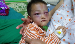 Xót cảnh bé trai 2 tuổi đẻ ra không biết mặt cha, đến khi mẹ lấy chồng thì bị cha dượng đánh đập phải nhập viện cấp cứu