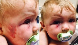 Dùng muỗng đánh dập mặt con gái 8 tháng tuổi nhưng không bị phạt tù, người mẹ độc ác còn nhắn tin khiêu khích chồng cũ