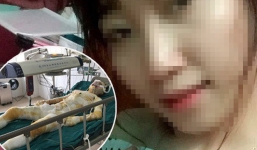 Thông tin mới nhất vụ cô gái bị tẩm xăng thiêu sống trong lúc ngủ