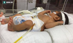 Hiếm gặp: Cháu bé sơ sinh 2 ngày tuổi ở Lào Cai bị vỡ dạ dày