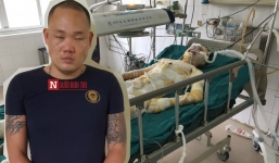 Đối tượng đốt nhân tình bỏng 95\% cơ thể: Bắt cá hai tay và chuyên chăn dắt “đào”