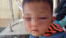 Tình tiết mới vụ bé trai 2 tuổi bị cha dượng tâm thần hành hung