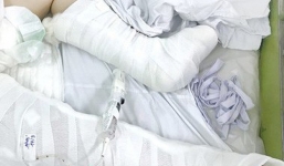 Bé gái ở Sài Gòn thoát chết thần kì khi rơi từ tầng 3 xuống