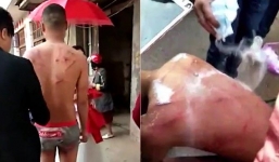 Hy hữu: Chú rể bị quất roi, xát muối vào vết thương hở trong ngày cưới
