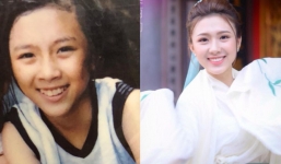 Sức mạnh của niềng răng: Cô bé trở nên xinh đẹp như hot girl sau 4 năm chịu đựng