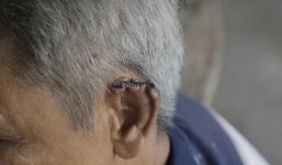 Cô gái bị chích điện, xẻo tai vì chậm trả 20 triệu đồng