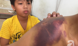 Mẹ bỏ đi lấy chồng, bé trai 12 tuổi nghỉ học vào bệnh viện chăm cha khờ bị tai nạn mà không có tiền cứu chữa