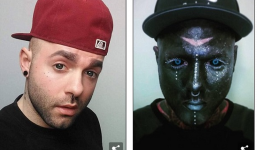 Câu chuyện buồn đằng sau cơ thể của 'dị nhân bóng tối': Chàng trai chật vật đi tìm lại bản ngã sau khi mắc bệnh nan y