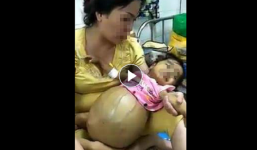 Cảnh báo: Bé gái ung thư tụy đã mất 3 tháng vẫn bị kẻ xấu nhẫn tâm đưa hình ảnh lên mạng trục lợi