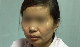 Vợ đâm chồng tử vong: Thay đồ, đắp chăn cho nạn nhân rồi đi đầu thú