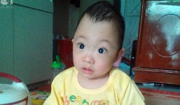 Bé trai 1 tuổi bị hẹp hộp sọ đã phẫu thuật thành công sau khi nhận được gần 50 triệu đồng từ các nhà hảo tâm