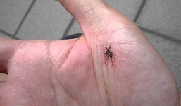 Đây là cách giảm ngứa cho vết muỗi đốt của bạn