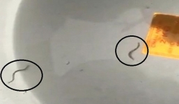 Phát hiện sinh vật lạ giống như đỉa trong nước máy ở Quảng Ninh