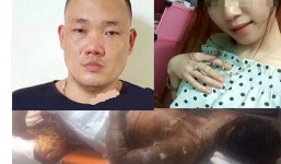 Cô gái xinh đẹp bị người yêu tẩm xăng thiêu sống ở Vĩnh Phúc đã qua đời