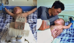 Xót xa chuyện người đàn ông bị vợ bỏ rơi, mỗi ngày dùng 15kg gạch đè lên chân đứa con 5 tuổi để chữa bỏng