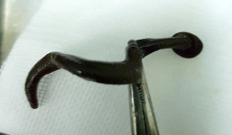 Con đỉa dài 15cm no máu được gắp ra khỏi hốc mũi một bệnh nhi