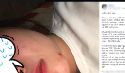 Nha Trang: Kẻ 'biến thái' kề dao vào cổ, dùng roi chích điện ép cô gái quan hệ trong đêm khiến dư luận xôn xao