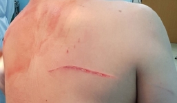 Mới nhất vụ bác sĩ Chiêm Quốc Thái bị chém ở phố đi bộ Nguyễn Huệ: Hung thủ lộ diện