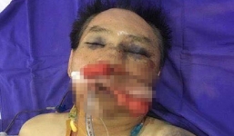 Nguyên đại tá công an và con trai đánh vợ chồng anh trai dập phổi