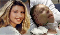 Dù đã qua đời sau khi bị thiêu sống, người phụ nữ vẫn có thể chỉ tội hung thủ trước tòa để tìm lại công lý cho mình