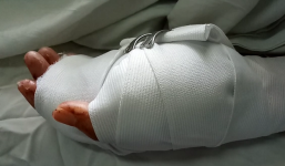 Vụ cô gái bị 3 thanh niên chém gần đứt lìa tay ở tiệm game bắn cá: Hé lộ nguyên nhân