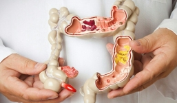 Căn bệnh ung thư xếp hàng thứ tư ở Việt Nam - thủ phạm liên quan chặt chẽ tới dinh dưỡng