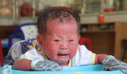 Người đầy vẩy ngứa như da trăn, bé gái 16 tháng tuổi bị bố mẹ bỏ rơi nên không có tiền chữa trị