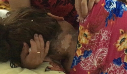 Đang làm cỏ, 1 phụ nữ bị sét đánh tử vong, 3 người cháy xém tóc