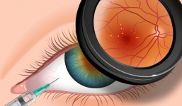 4 căn bệnh ở mắt nếu không chữa trị sớm có thể dẫn tới nguy cơ mù lòa