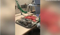 Hình ảnh phổi của một người khỏe mạnh và người hút thuốc lá suốt 20 năm khiến nhiều người hãi hùng