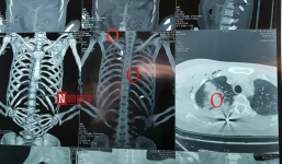 Sức khỏe hiện tại của nữ Giám đốc bị bắn tại phòng làm việc ở Bắc Giang giờ ra sao?