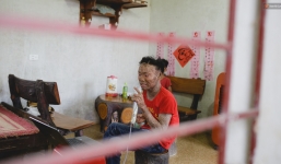 Chàng trai 'người cá' lạc quan ở Hà Nội: Nhìn thấy bộ dạng của mình, nhiều người hỏi sao không chết đi, sống để làm gì?