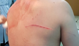 Thông tin mới nhất vụ bác sĩ Chiêm Quốc Thái bị truy sát ở phố đi bộ Nguyễn Huệ