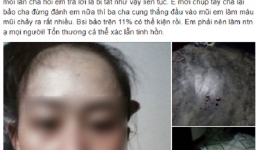 Cuộc đời chìm trong bi kịch kép của người mẹ trẻ: Chồng nghiện ngập đi tù, cha ruột say rượu liên miên, đánh con gãy xương mũi