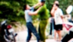 Truy bắt nhóm thanh niên đánh 2 chiến sĩ công an nhập viện