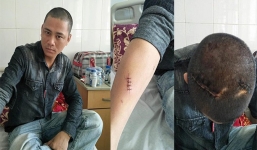 Đến nhà giám đốc lấy tiền cọc, nhân viên xe buýt bị chém nhiều nhát vào đầu