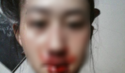 Cuộc đời chìm trong bi kịch kép của người mẹ trẻ: Chồng nghiện ngập đi tù, cha ruột say rượu liên miên, đánh con gãy xương mũi