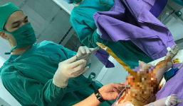 Quảng Ninh: Cứu sống một trẻ sơ sinh bị thoát vị rốn bẩm sinh