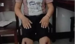 Giáo viên thể dục bị điều tra vì bắt học sinh đi bộ bằng đầu gối đến tóe máu