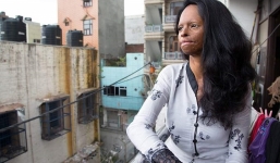 Ám ảnh gương mặt bị tàn phá kinh hoàng vì axit của phụ nữ Ấn Độ