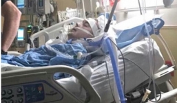 Chủ quan với chiếc răng sâu, chàng trai 26 tuổi đã ra đi mãi mãi